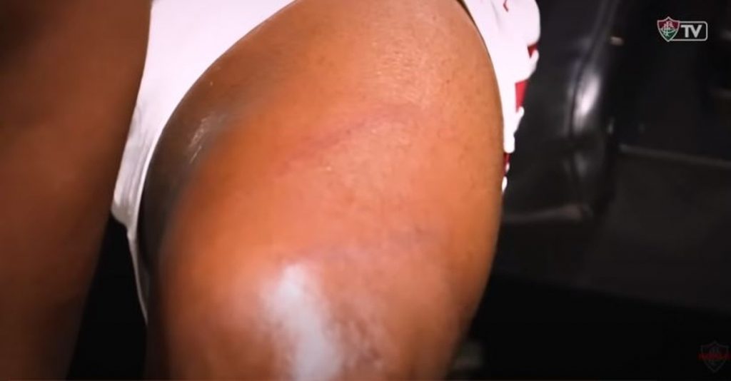 Behind the Scenes: Fluminense shows Rodrigo Caillou's lock on Cazares' thigh |  Fluminense