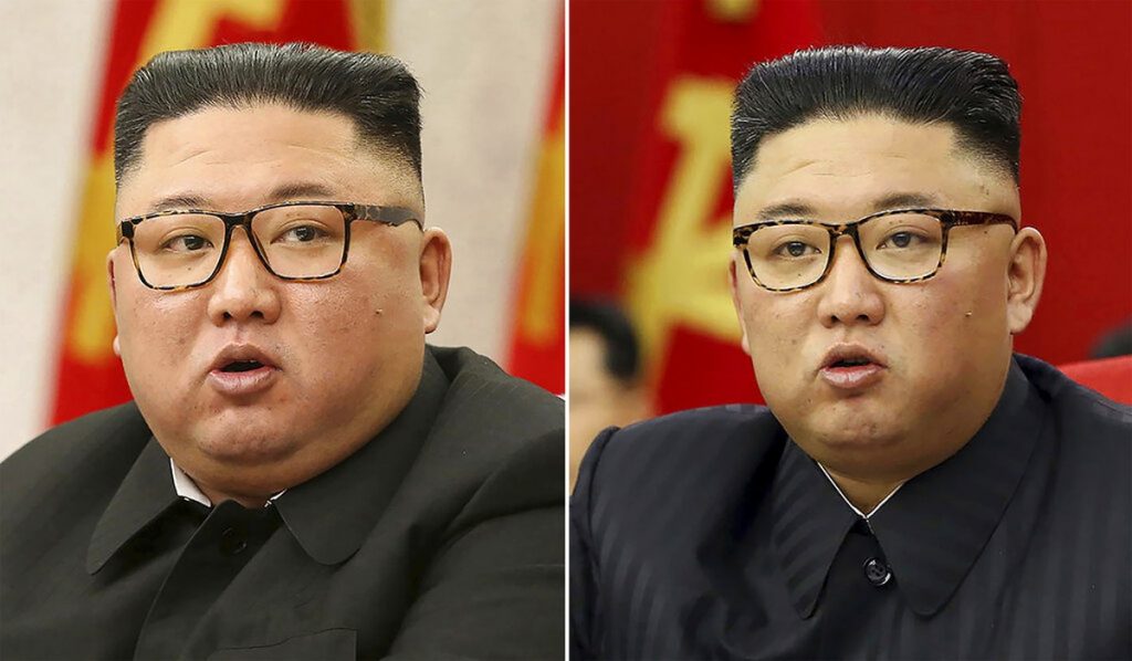 Pictures of Kim Skinner's intrigue analysts.  The North Korean dictator's health status is a frequent target of speculation |  Scientist