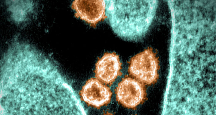 A Swiss epidemiologist says a virus similar to SARS-CoV-2 may have been found and hidden in 2013