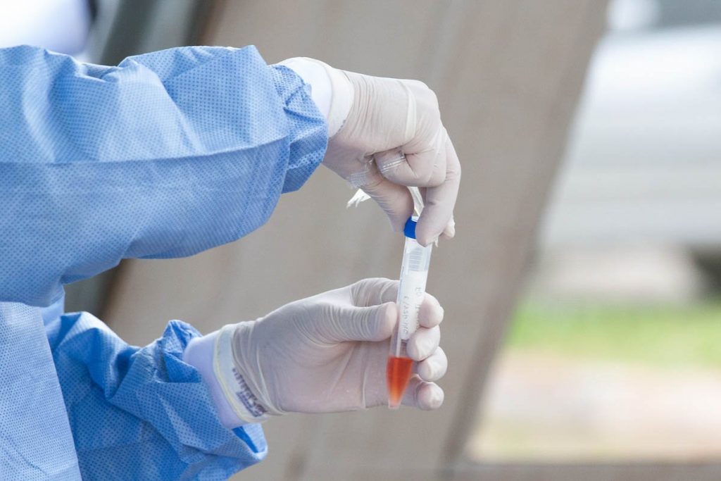 Lab suspects it misdiagnosed 43,000