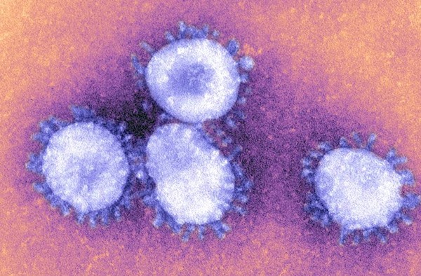 In the color illustration, different viruses are represented