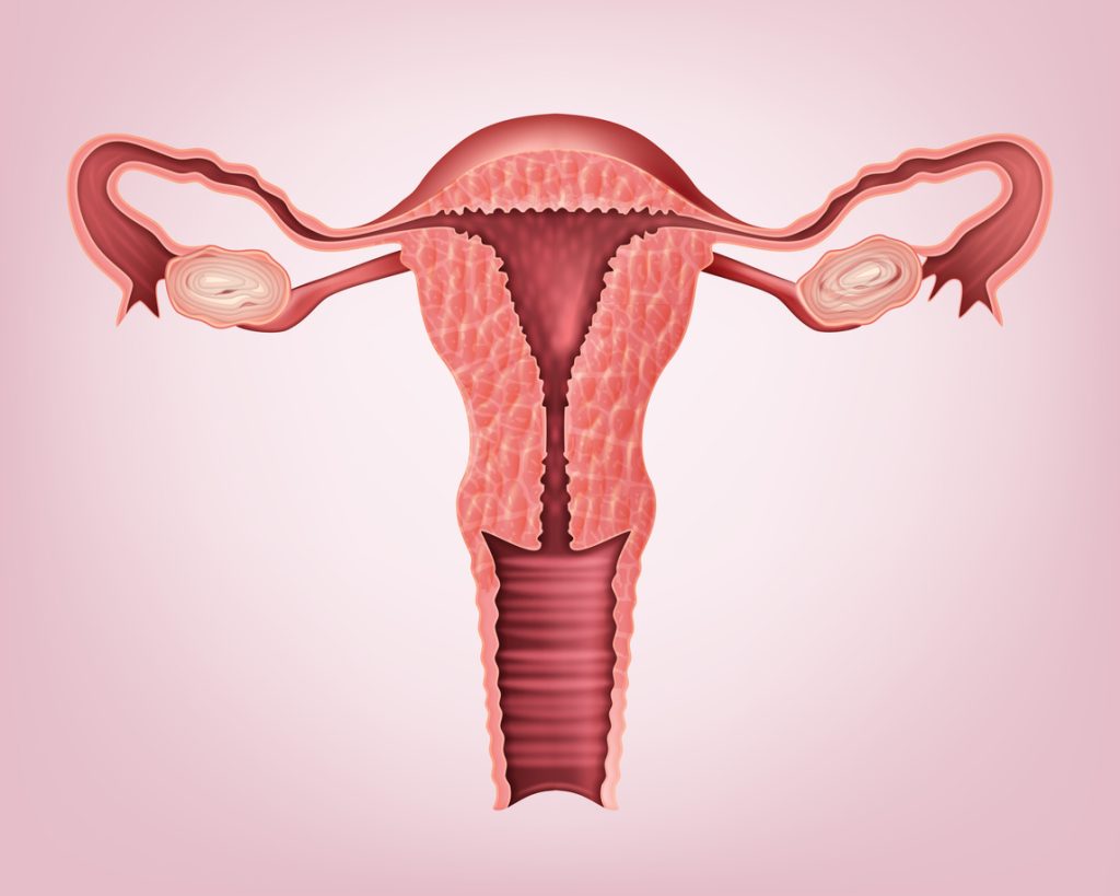 The study found a condition that increases the risk of uterine cancer