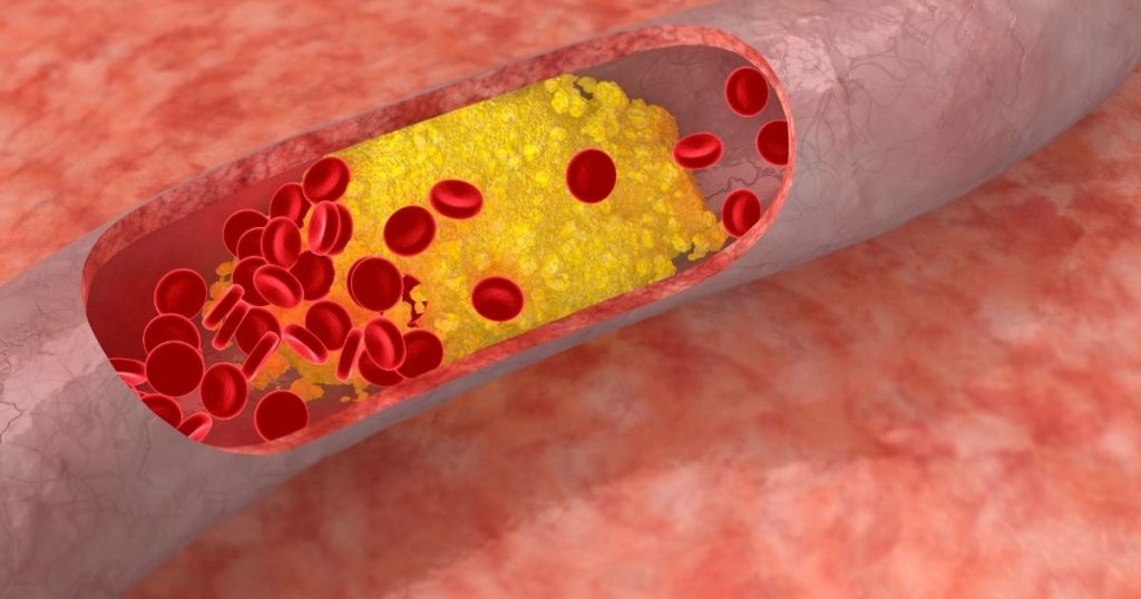 3 ways to control cholesterol and reduce the risk of disease