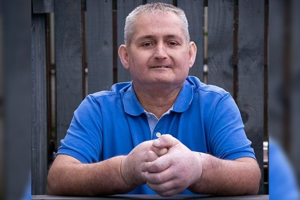 A person living in the UK undergoes double arm transplant surgery