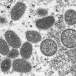Paraguay activates epidemiological alert against monkeypox