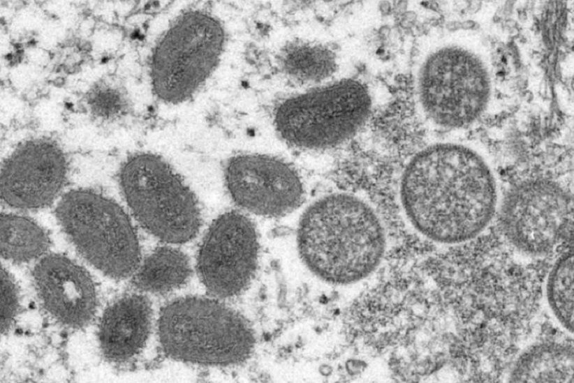 Paraguay activates epidemiological alert against monkeypox
