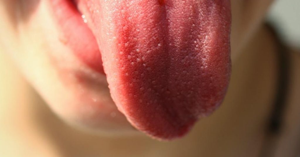 The tongue can reveal health problems: seeing colors and meanings