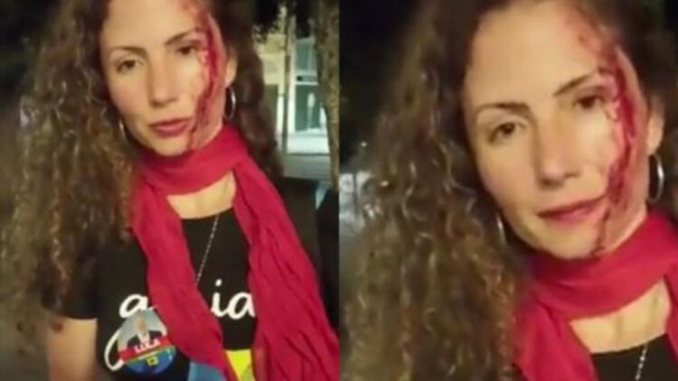 CNN journalist, Magalia is assaulted in the street as she walks with Lula poster: 'I was attacked'