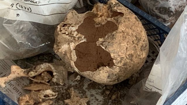 Skull and bone fragments