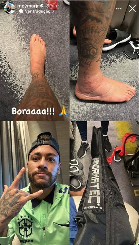 Neymar publishes a picture of the treatment on his right foot
